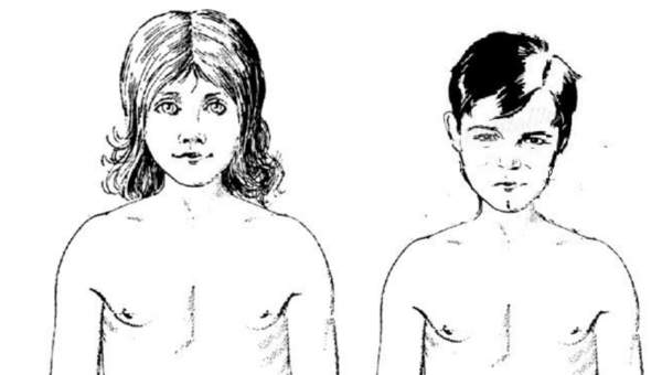 cambios físicos en la pubertad cambios físicos en la pubertad