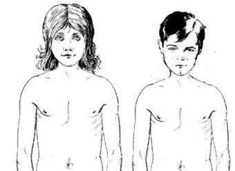 cambios físicos en la pubertad cambios físicos en la pubertad