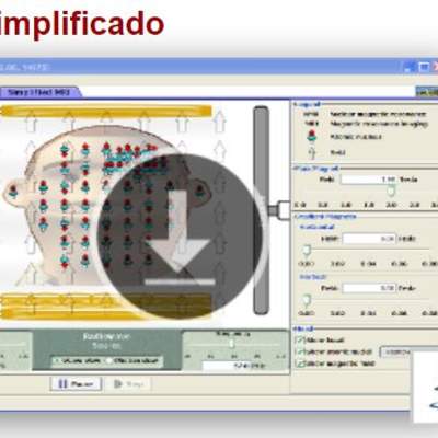 MRI Simplificado MRI Simplificado