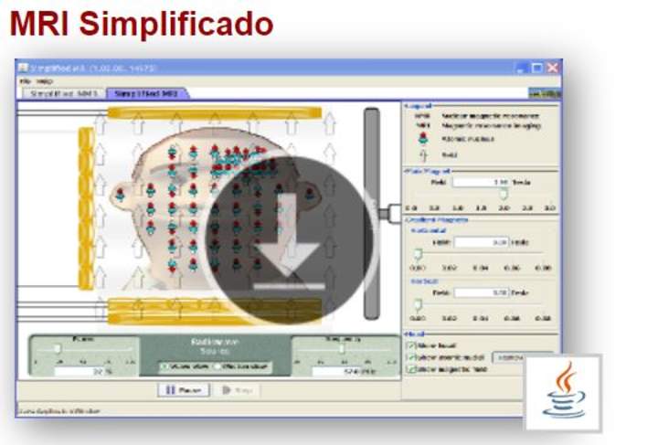 MRI Simplificado MRI Simplificado