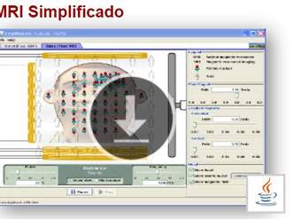 MRI Simplificado MRI Simplificado